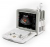 Сканер диагностический ультразвуковой AcuVista RS880i (с цветным допплером)